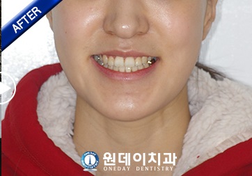 수술 후